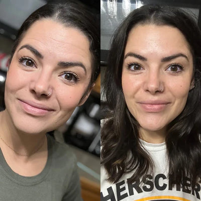 SkinLift Face Tapes