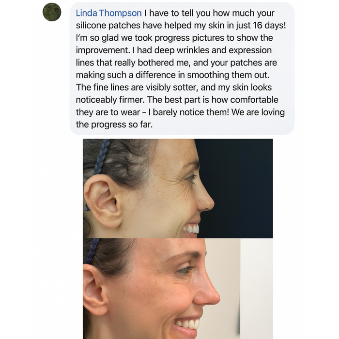 SkinLift Face Tapes