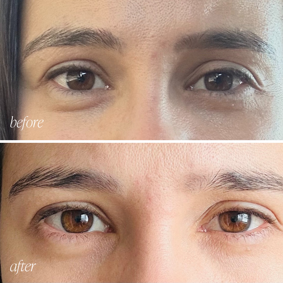 Under-Eye Peptide Collagen Patches