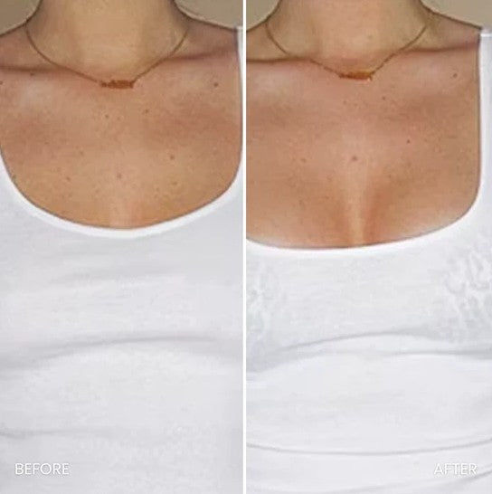 Natural Bust Lift – No Surgery or Padding
