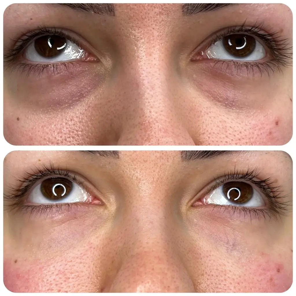 Under-Eye Peptide Collagen Patches
