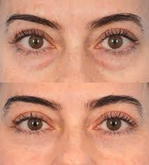 Under-Eye Peptide Collagen Patches