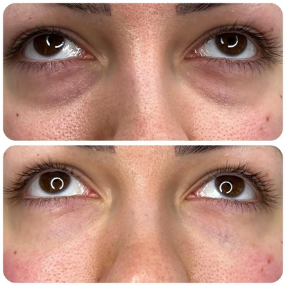 Under-Eye Peptide Collagen Patches